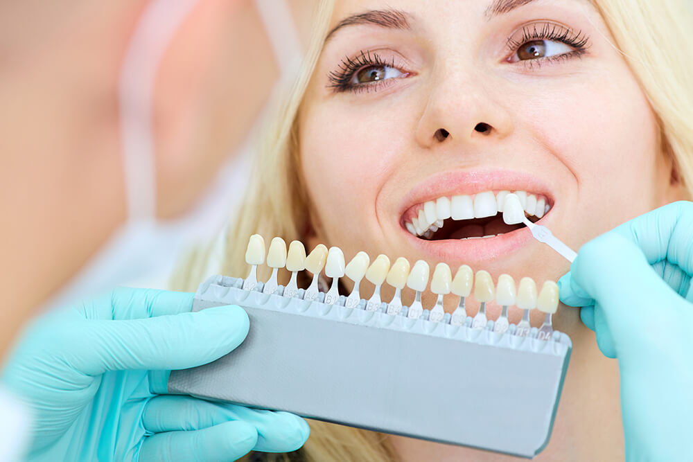 patient comparing teeth to various stages of whitening with dental veneers