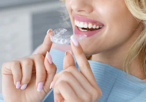 Teeth Alignment issues that Invisalign can fix in Falls Church, VA at Pike Smiles