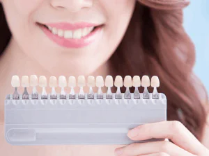 Dos and Don'ts of Teeth Whitening in Falls Church, VA at Pike Smiles